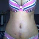 9day... below the belly button is old belly button