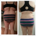 Before BBL & 6 weeks post op. Salama did a great job on my flanks.
