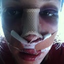 Oh yeah sexy! this was right when I got home from surgery