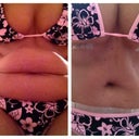2 1/2 weeks PO