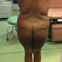 Day of the surgery