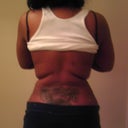 Still very very swollen.  It has been doing down day by day.  I just wish it hurry up.  I trust my PS and he has made good on all his promises so I believe that my back with eventually be completely flat once all the swelling goes down.  Had lipo done on my entire back.