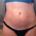 Pre