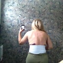 Purple bruses from lipo