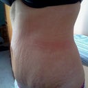 5 weeks po