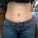 8 weeks po, still feel swollen and puffy