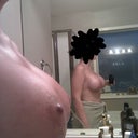 wow, looking good! I am using mederma scar gel everyday after showering.
