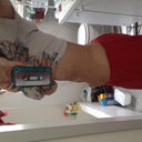 Day 2: (day after Coolsculpting) swollen!!