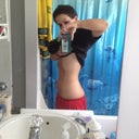 6/9,10 days later
swelling gone, looks like there are results already