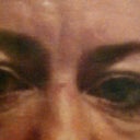 Before.. heavy under eye sacks
