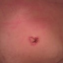 4-7-11 close up on belly button