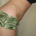 Ignore the silicone strips and the compresion garment lines in the skin but, bending over!  WoooHoo!