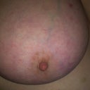 right side so red from weight