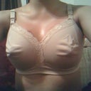Post opp Day 3 in surgical bra