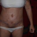4 weeks PO