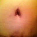 Finally, my BB is looking a little better. The middle part of my scar is the darkest.