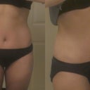 Well, hello abs! I haven't seen you in 17 days!! <3 I haven't worked out since the surgery, and of course, I have been really swollen, but this makes me want to do a bunch of crunches so I can see what it looks like tomorrow morning!
