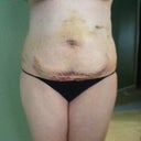 Front, 3 days