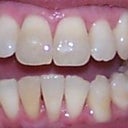 10-24-2012 Tray 17/24