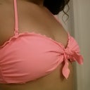 Pre-Op in bikini top - Before