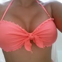 After - Post op day 29 In bikini top again. Looking good and loving it! Big difference.