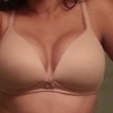 Post Op day 28