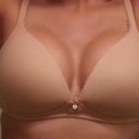 Post Op day 28
