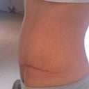 20 weeks left side view