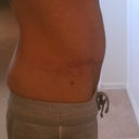 20 weeks right side view