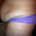 left side