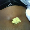 Post op day 1 belly