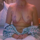 markings before surgery.... look how far up my nipples will be moved!