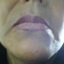 a year after the lift do you see a younger person? look at the deep lines around my mouth and the sagging and dropping jwols.