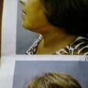 before the surgery I did not have a turkey neck and my skin was soft and nice.