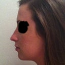 self morph