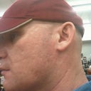 look at my lower chin, this it's like this on  both sides, he didnt go as far down as the first time, says there is no way he would have missed it, lower chin is one treatment, upper face is 2.
