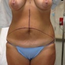 Morning of surgery....Bye Bye old belly and boobies!!!
