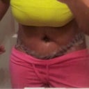 very swollen