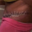 swollen
