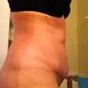 Week 5-No more bruises