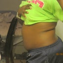 Day before surgery Side View