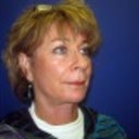 Here I am AFTER the procedure, from the right.