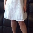Bare legs 9 months post surgery.