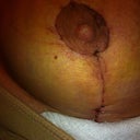 close up of left, day 8