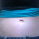 Today! 8 Months Post Op