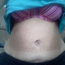 11 weeks post op front sitting