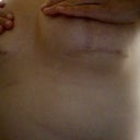 Left short incision.