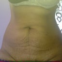 1 week before surgery i try to hold my breath!!
