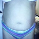 Before surgery