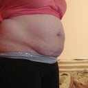 Prior to surgery....